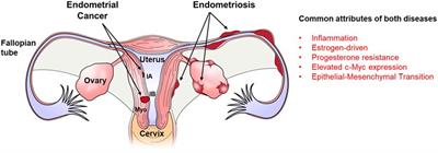 Targeting c-MYC: a potential non-hormonal therapeutic approach for endometriosis treatment